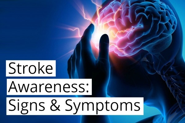 Stroke Awareness: Signs & Symptoms Xray holding brain